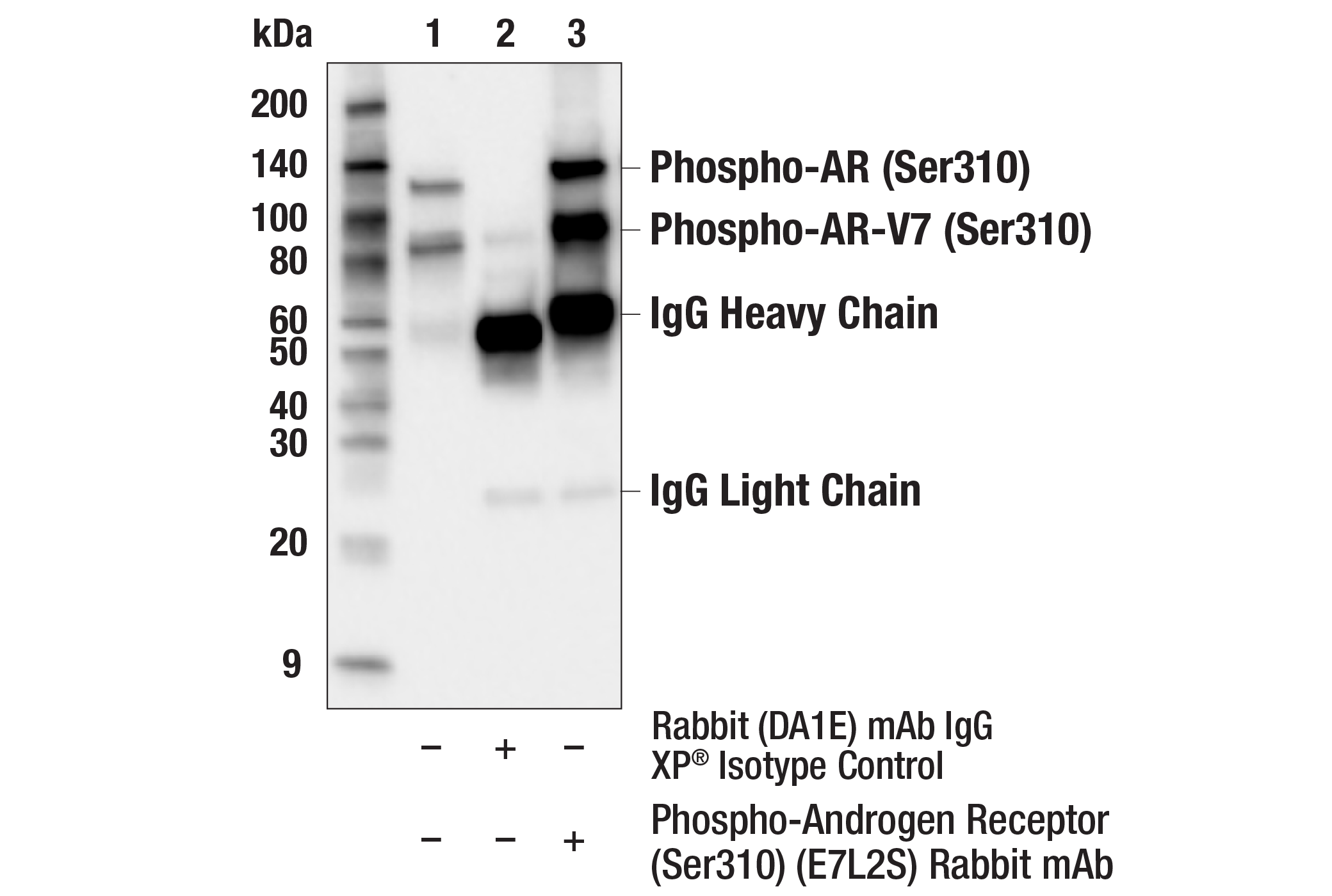 Immunoprecipitation Image 1: Phospho-Androgen Receptor (Ser310) (E7L2S) Rabbit mAb