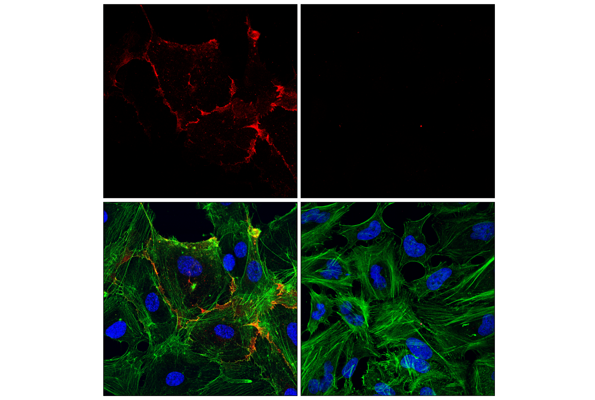 Immunofluorescence Image 1: CD31 (PECAM-1) (89C2) Mouse mAb (Alexa Fluor® 555 Conjugate)