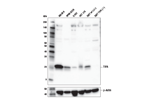 Western Blotting Image 1: TIFA Antibody