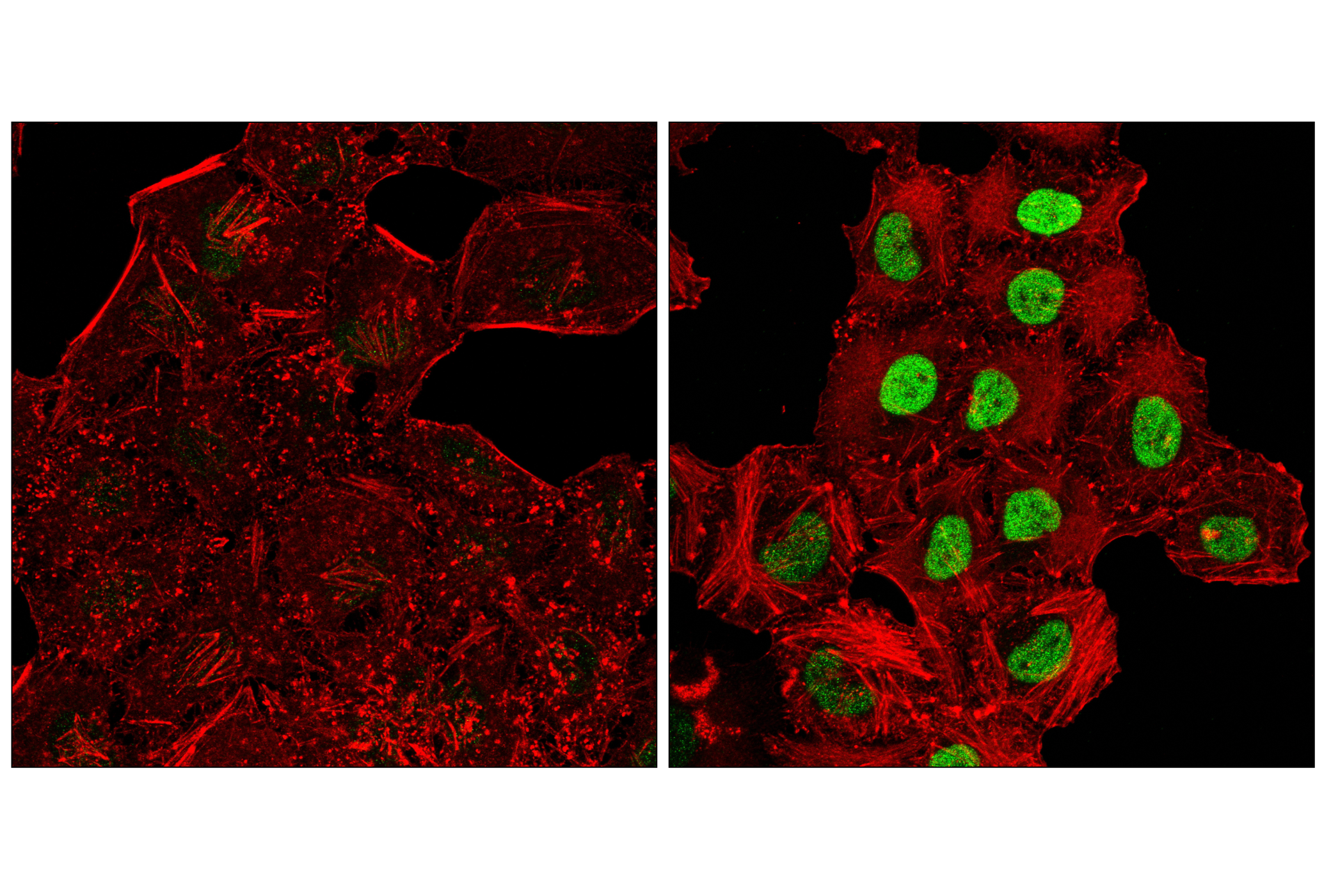 Immunofluorescence Image 2: c-Fos (E2I7R) XP® Rabbit mAb (BSA and Azide Free)