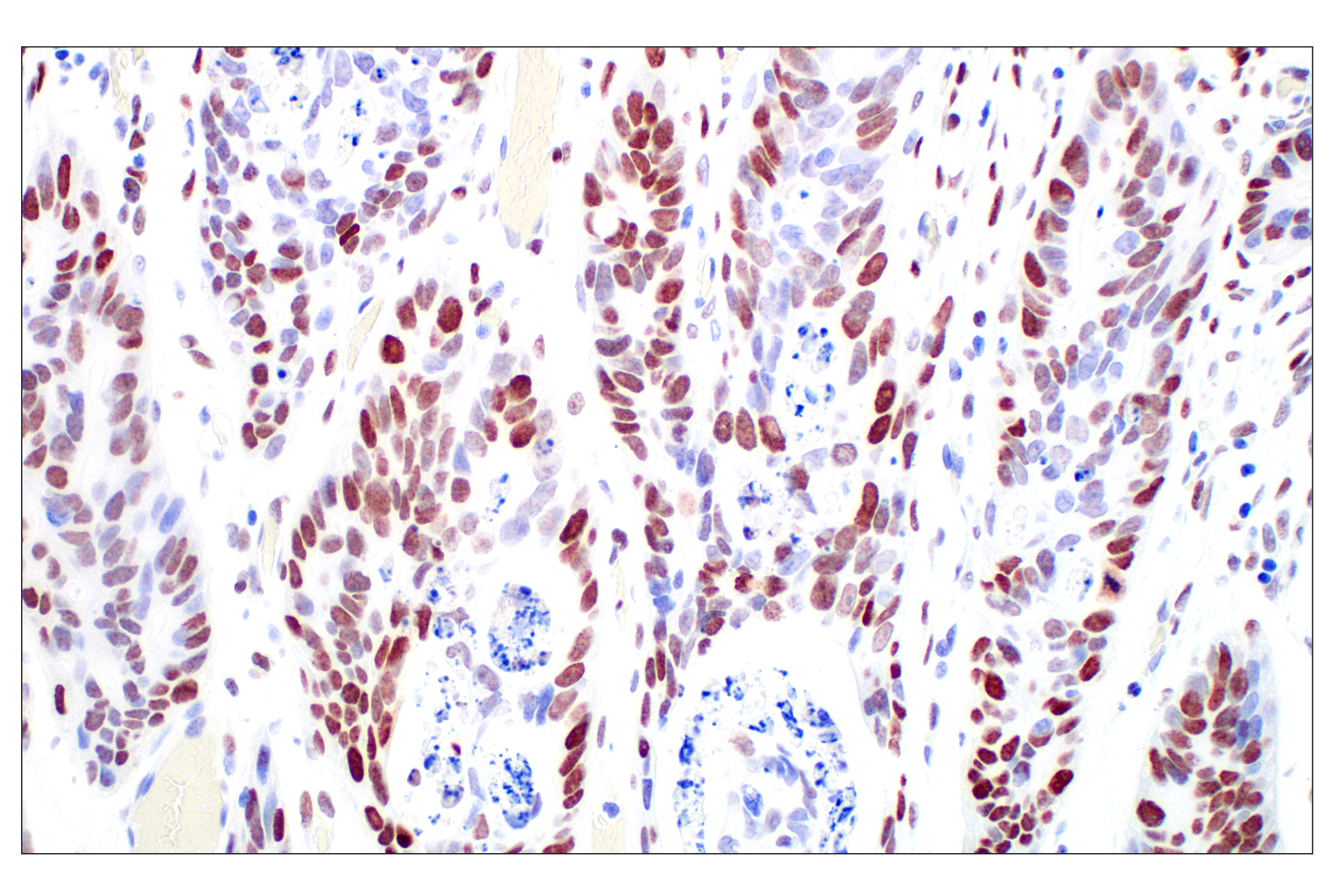 Immunohistochemistry Image 1: c-Fos (E2I7R) XP® Rabbit mAb (BSA and Azide Free)