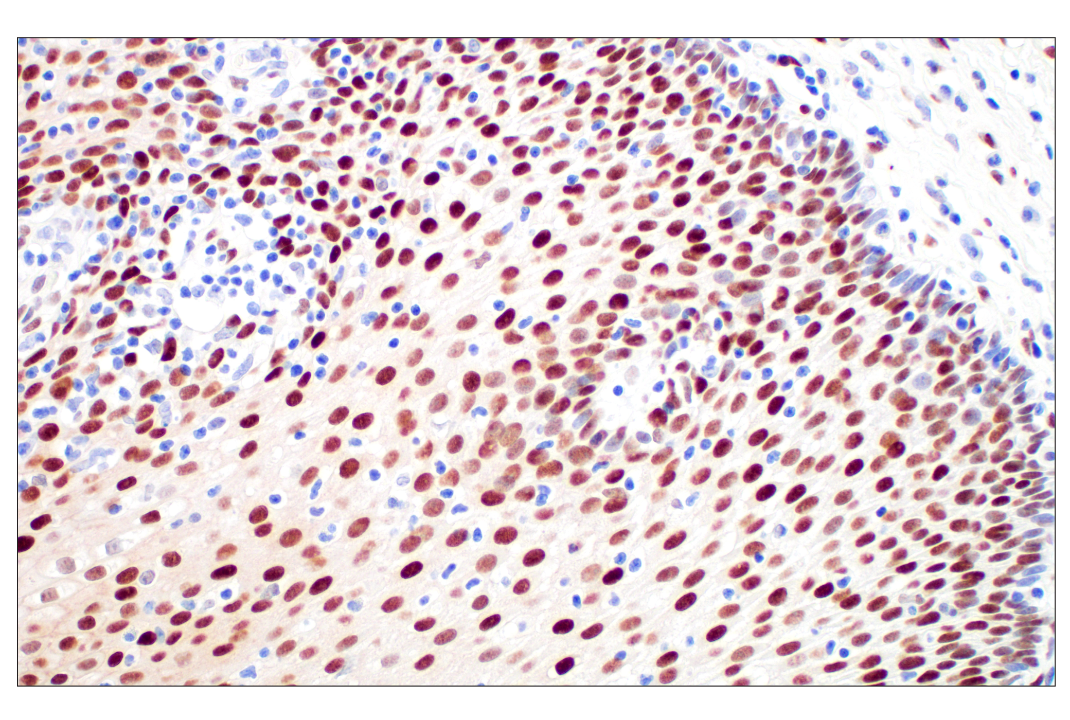 Immunohistochemistry Image 6: c-Fos (E2I7R) XP® Rabbit mAb (BSA and Azide Free)
