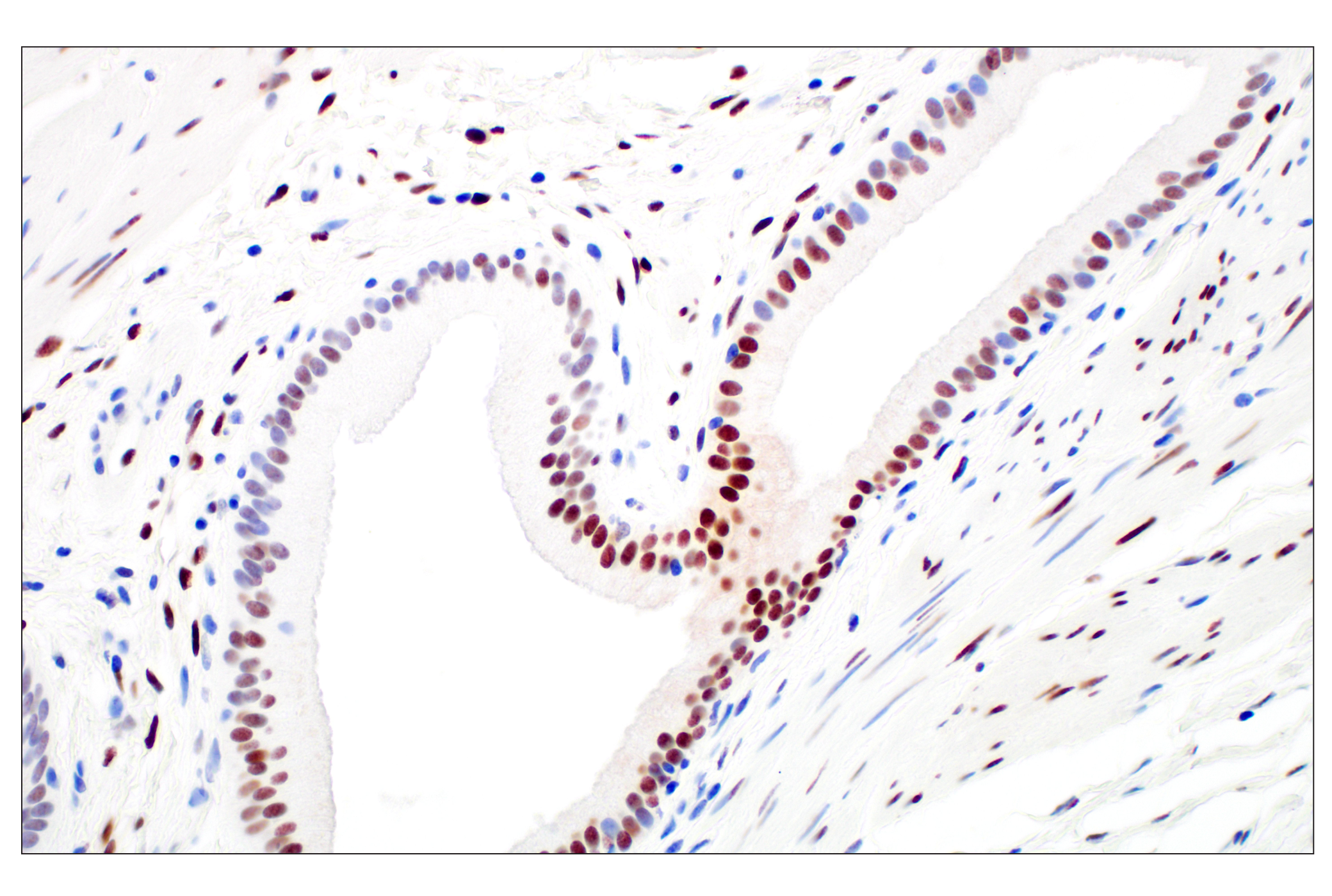 Immunohistochemistry Image 5: c-Fos (E2I7R) XP® Rabbit mAb (BSA and Azide Free)