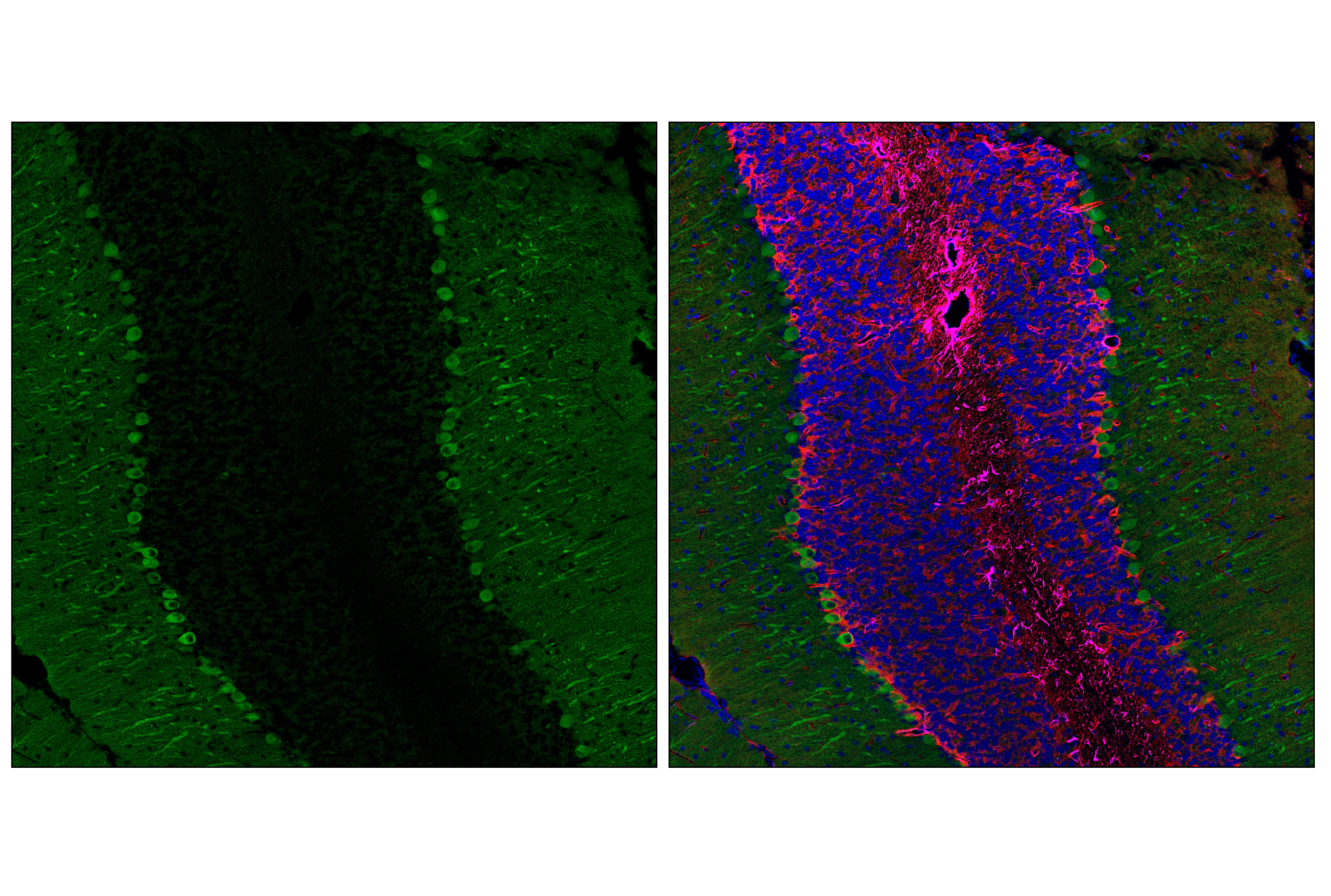 Immunofluorescence Image 1: PIP4K2C (E7P3S) Rabbit mAb