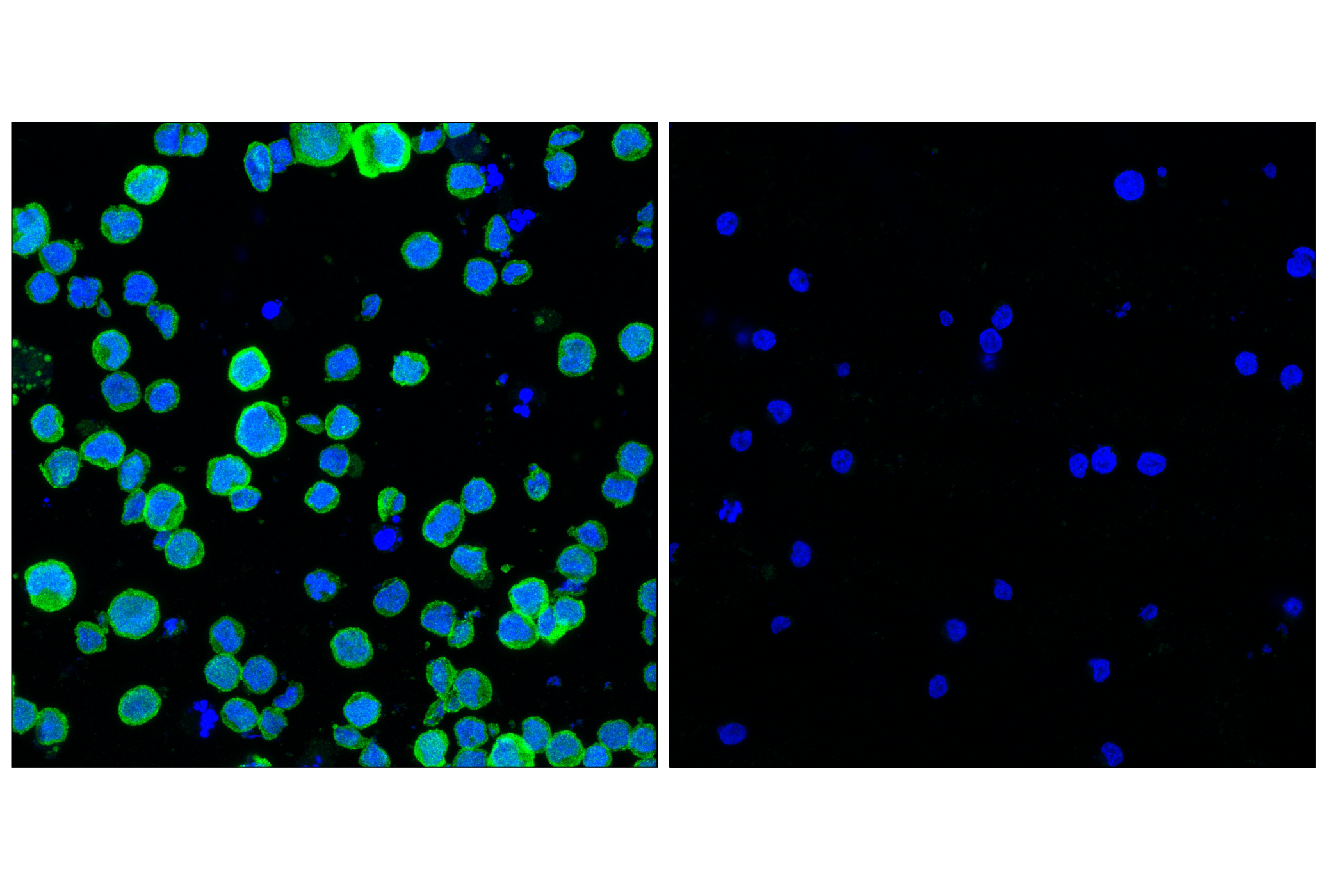 Immunofluorescence Image 2: PIP4K2C (E7P3S) Rabbit mAb
