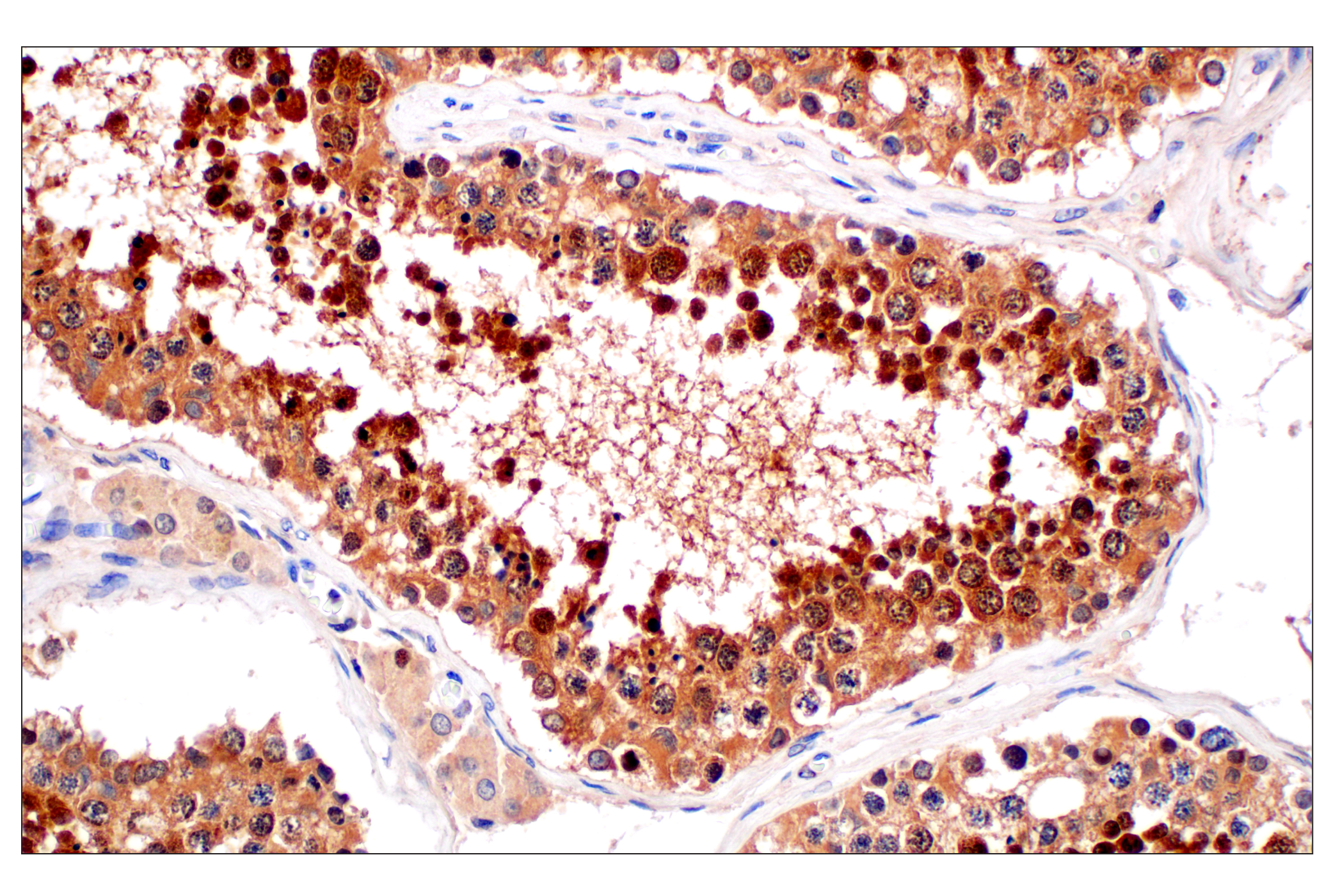 Immunohistochemistry Image 5: PIP4K2C (E7P3S) Rabbit mAb