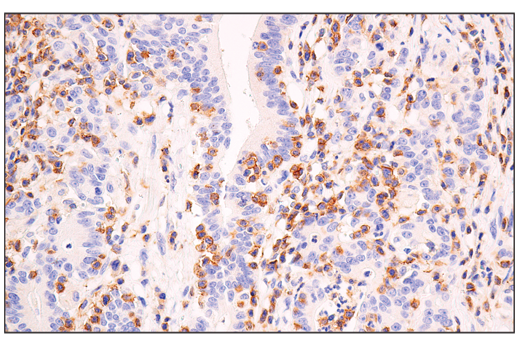 Immunohistochemistry Image 2: Semaphorin-4D/CD100 (E5C3B) XP® Rabbit mAb (BSA and Azide Free)