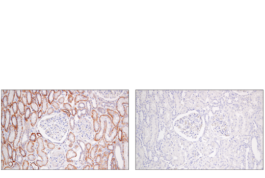 Immunohistochemistry Image 4: Semaphorin-4D/CD100 (E5C3B) XP® Rabbit mAb (BSA and Azide Free)