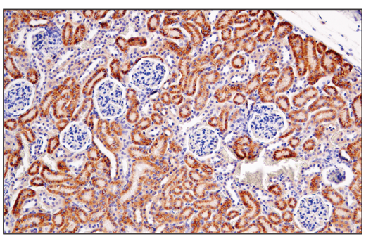 Immunohistochemistry Image 6: Semaphorin-4D/CD100 (E5C3B) XP® Rabbit mAb (BSA and Azide Free)