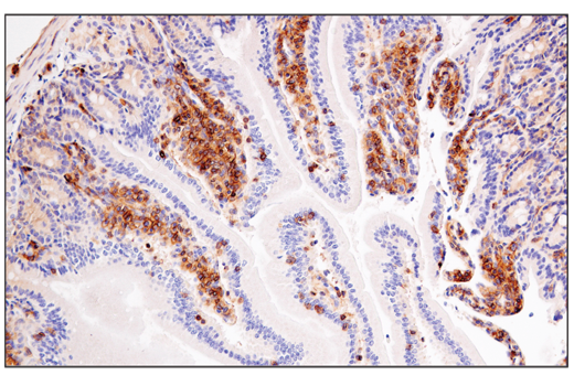 Immunohistochemistry Image 7: Semaphorin-4D/CD100 (E5C3B) XP® Rabbit mAb (BSA and Azide Free)