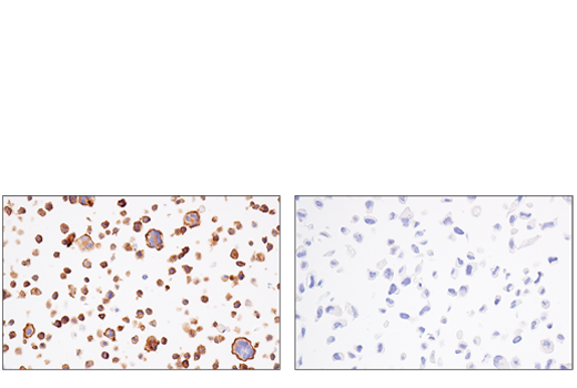 Immunohistochemistry Image 8: Semaphorin-4D/CD100 (E5C3B) XP® Rabbit mAb (BSA and Azide Free)
