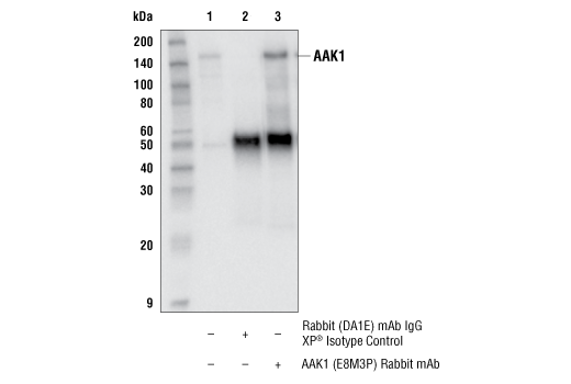 Immunoprecipitation Image 1: AAK1 (E8M3P) Rabbit mAb