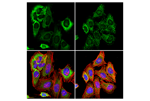Immunofluorescence Image 1: G3BP1 (E9G1M) XP® Rabbit mAb