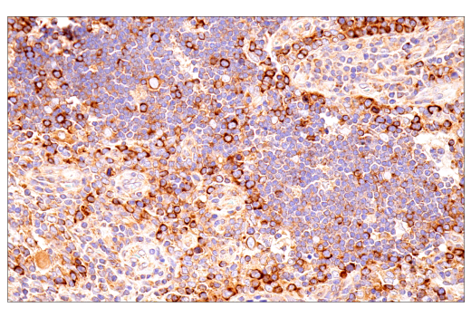 Immunohistochemistry Image 8: G3BP1 (E9G1M) XP® Rabbit mAb