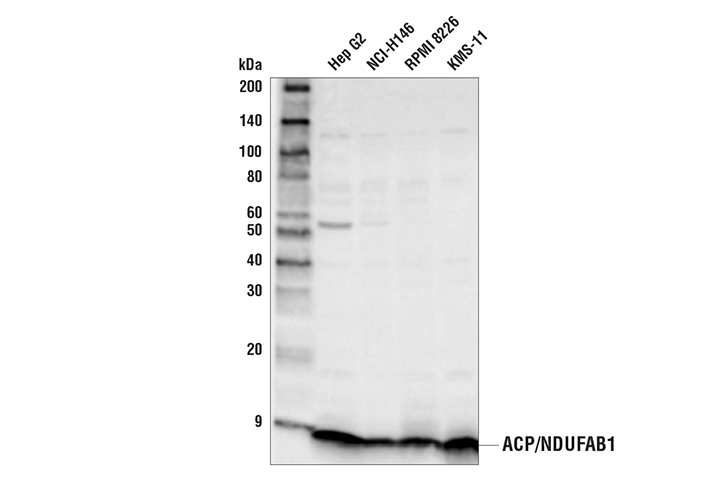 Western Blotting Image 1: ACP/NDUFAB1 Antibody