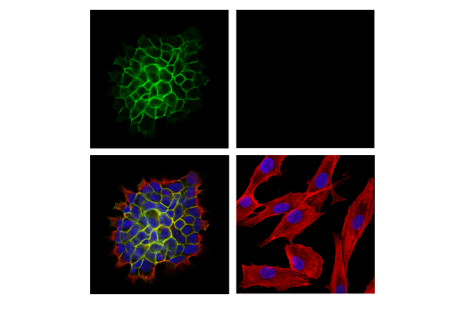 Immunofluorescence Image 1: PTPRF/LAR (E6W4X) Rabbit mAb