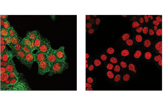 Immunofluorescence Image 2: Mouse (E5Y6Q) mAb IgG2a Isotype Control