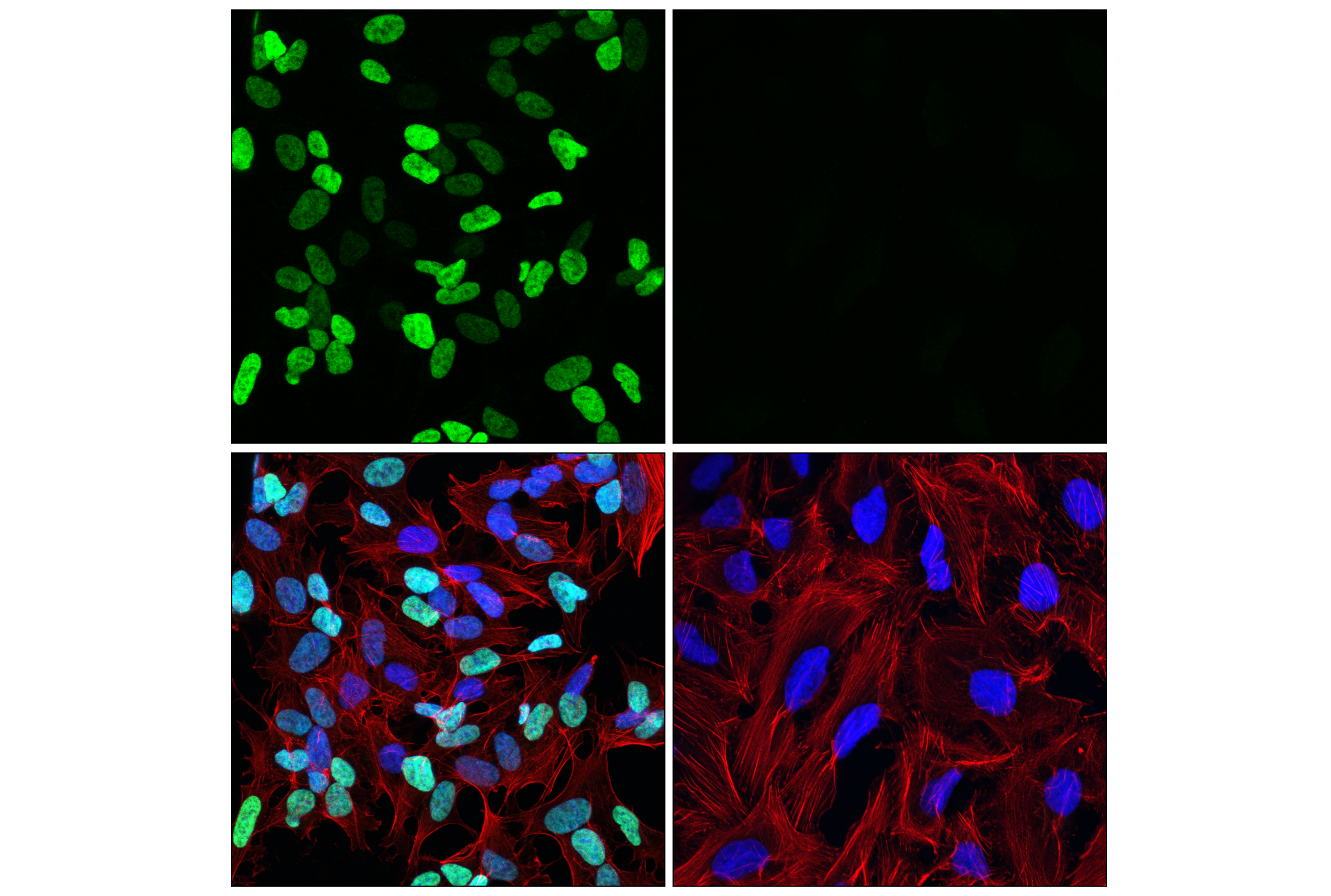 Immunofluorescence Image 1: GATA-2 (E9T6F) Rabbit mAb (Alexa Fluor® 488 Conjugate)