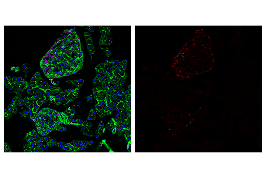 Immunofluorescence Image 2: Tox/Tox2 (E6G5O) Rabbit mAb (Alexa Fluor® 594 Conjugate)