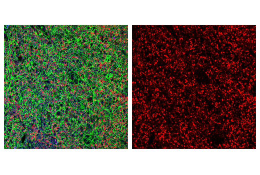 Immunofluorescence Image 3: Tox/Tox2 (E6G5O) Rabbit mAb (Alexa Fluor® 594 Conjugate)