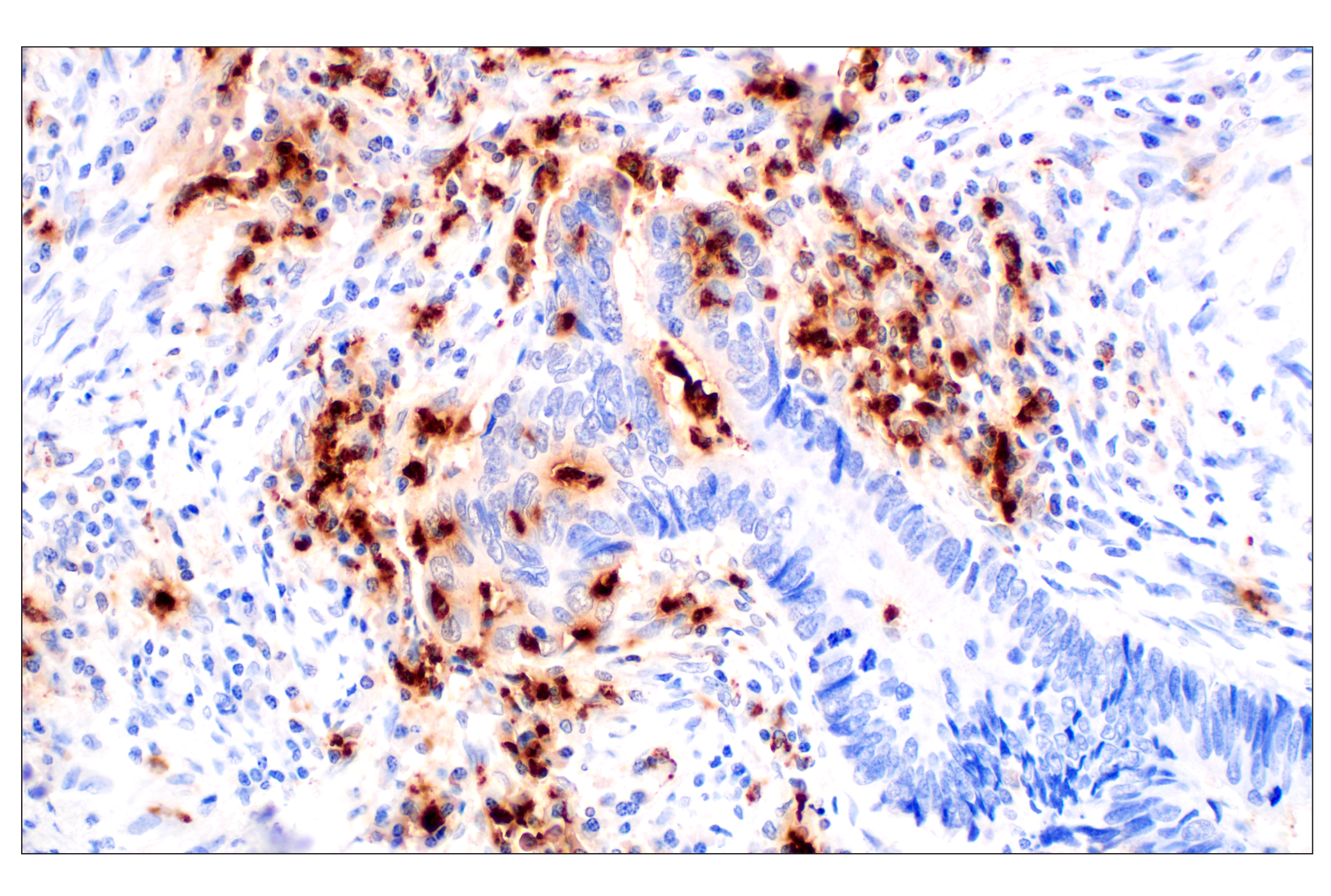 Immunohistochemistry Image 2: Neutrophil Elastase (F4H3X) Rabbit mAb (BSA and Azide Free)