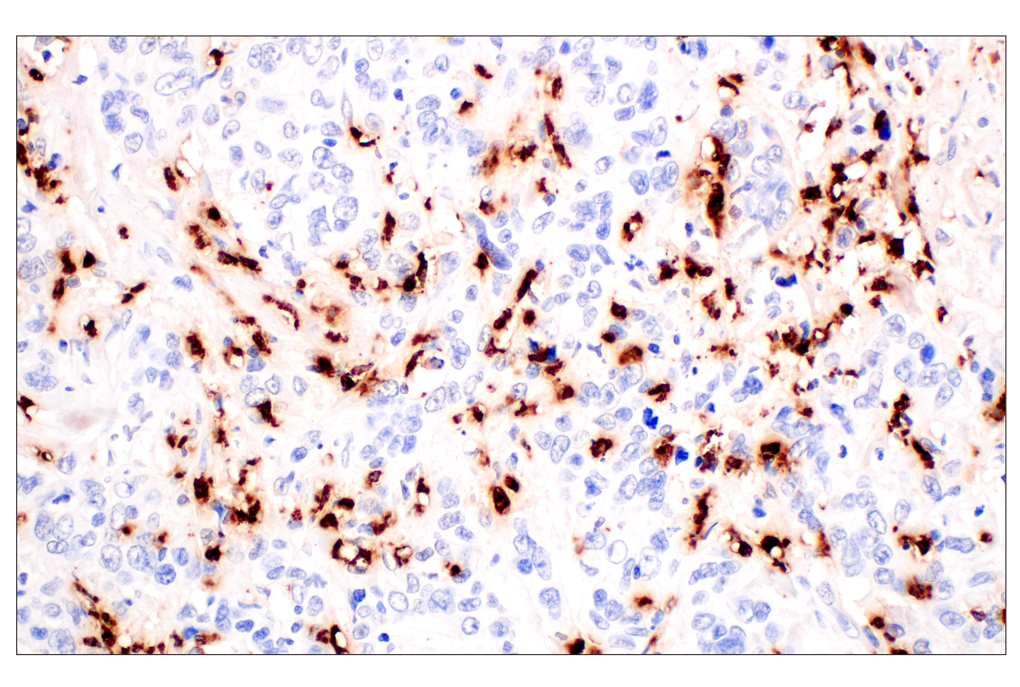 Immunohistochemistry Image 5: Neutrophil Elastase (F4H3X) Rabbit mAb (BSA and Azide Free)