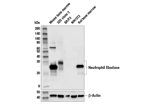 Western Blotting Image 1: Neutrophil Elastase (E6K6Q) Rabbit mAb
