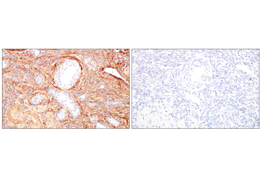 Immunohistochemistry Image 9: COL14A1 (E5W8S) Rabbit mAb