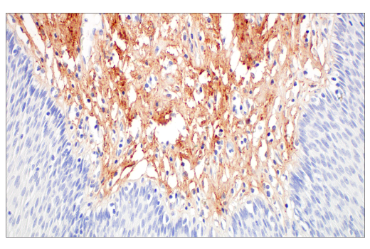 Immunohistochemistry Image 8: COL14A1 (E5W8S) Rabbit mAb
