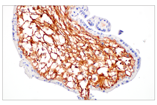 Immunohistochemistry Image 6: COL14A1 (E5W8S) Rabbit mAb