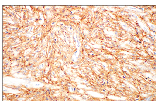 Immunohistochemistry Image 7: COL14A1 (E5W8S) Rabbit mAb