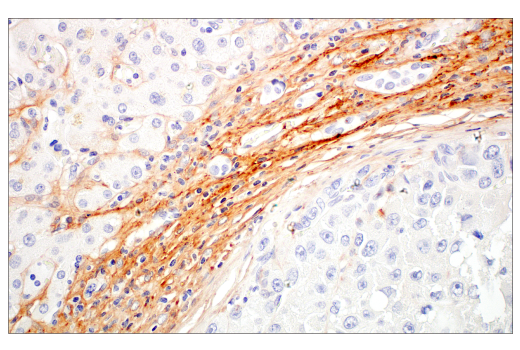 Immunohistochemistry Image 3: COL14A1 (E5W8S) Rabbit mAb