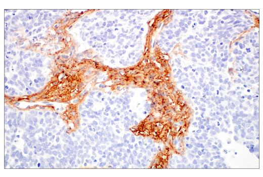 Immunohistochemistry Image 2: COL14A1 (E5W8S) Rabbit mAb