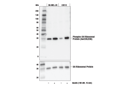 Western Blotting Image 1: Phospho-S6 Ribosomal Protein (Ser235/236) (E2R1O) Mouse mAb