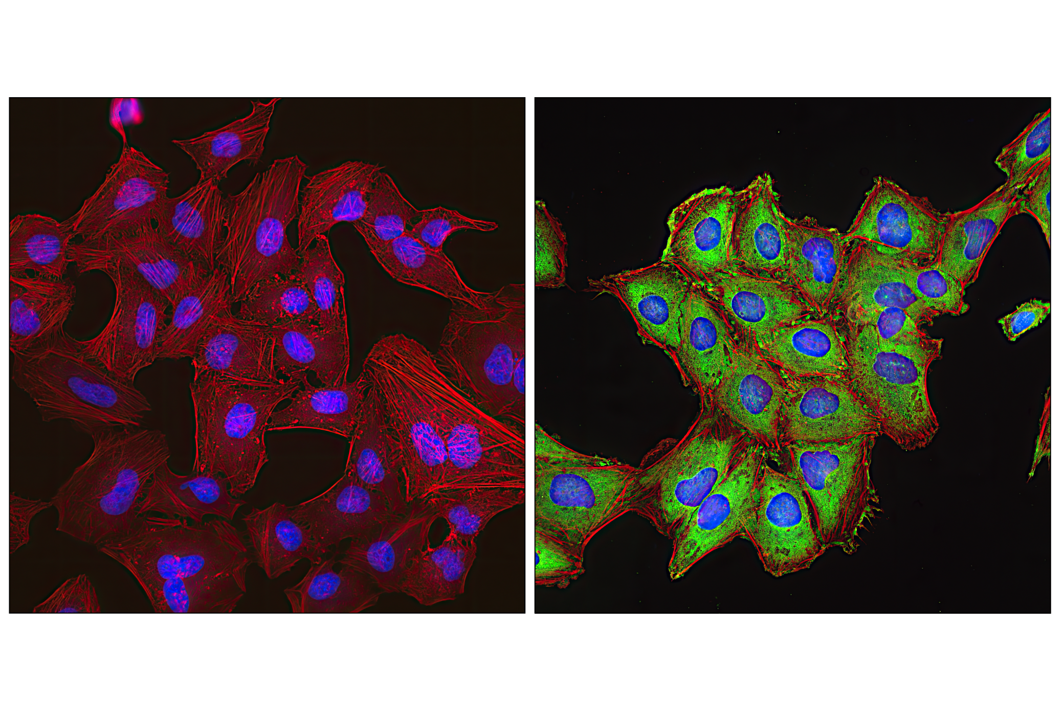 Immunofluorescence Image 1: Phospho-S6 Ribosomal Protein (Ser235/236) (E2R1O) Mouse mAb