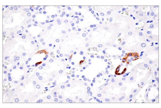 Immunohistochemistry Image 5: CPS1 (E9I9U) Rabbit mAb
