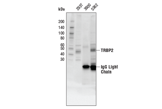 Immunoprecipitation Image 1: TRBP2 (D7C8K) Rabbit mAb