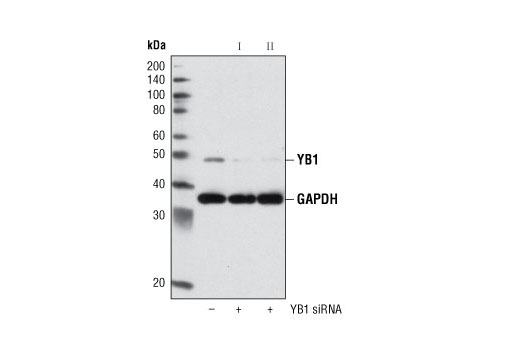  Image 1: SignalSilence® YB1 siRNA II