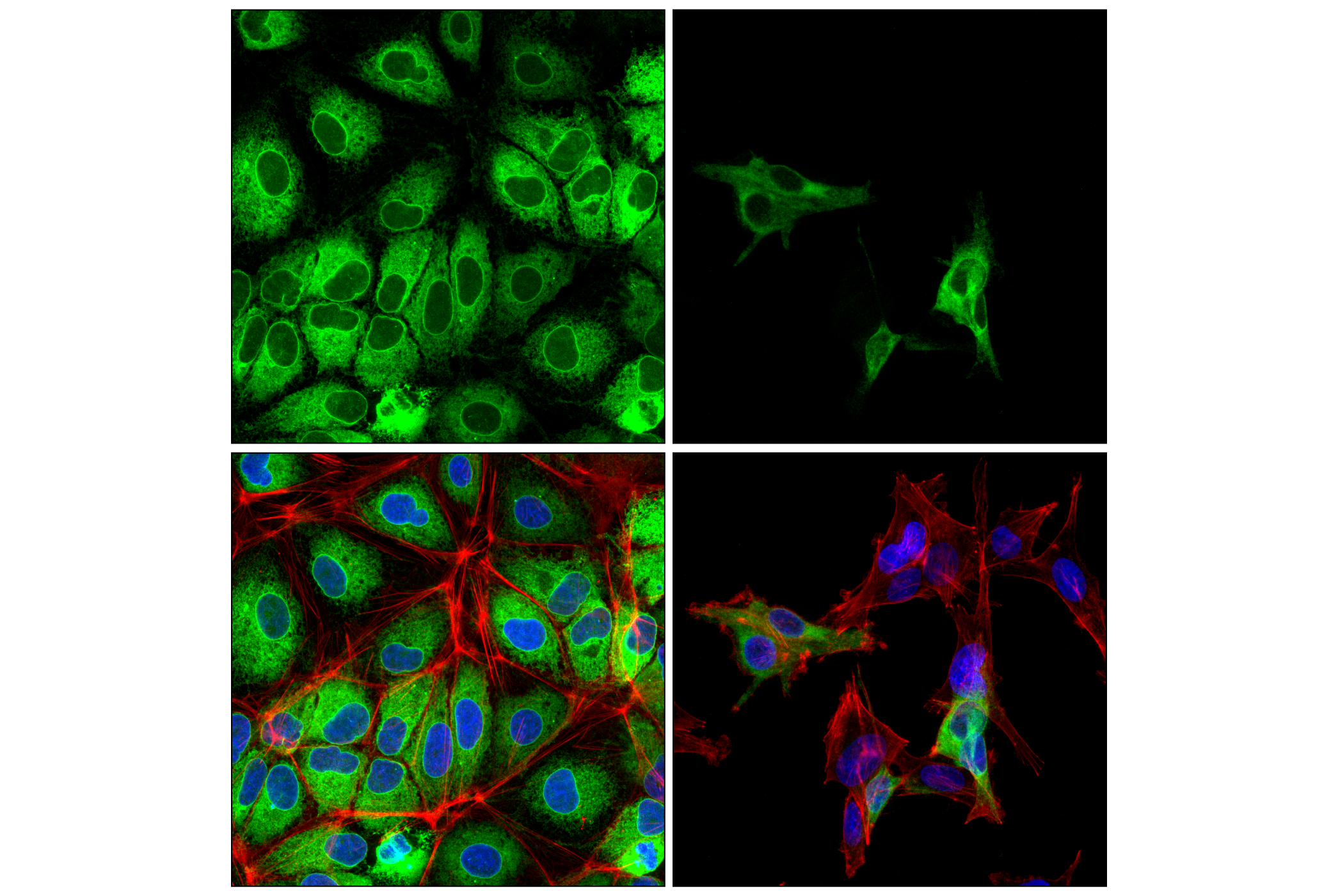 Immunofluorescence Image 1: DHCR7 (F7I5B) Rabbit Monoclonal Antibody