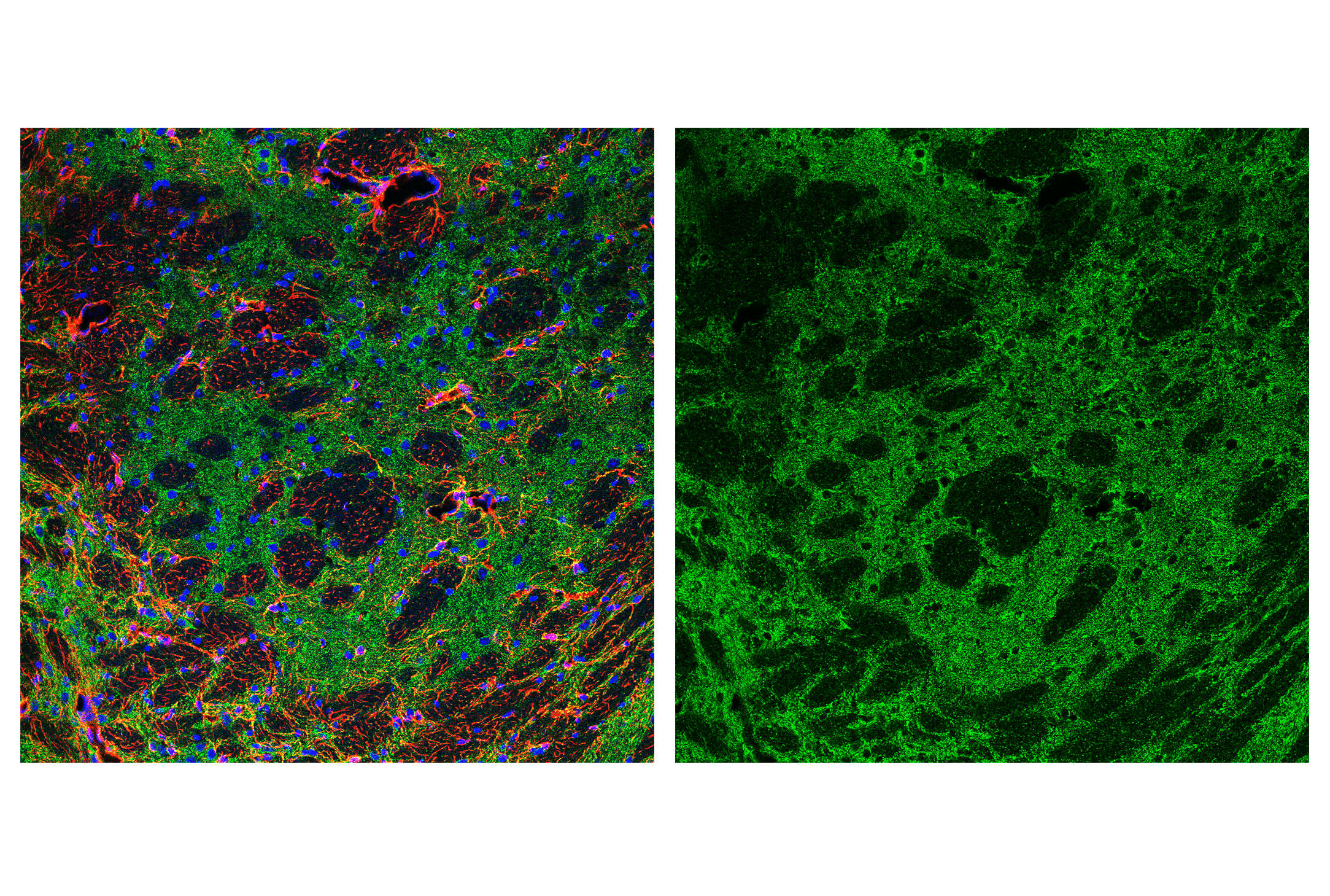 Immunofluorescence Image 5: AIF (D39D2) XP® Rabbit mAb (BSA and Azide Free)