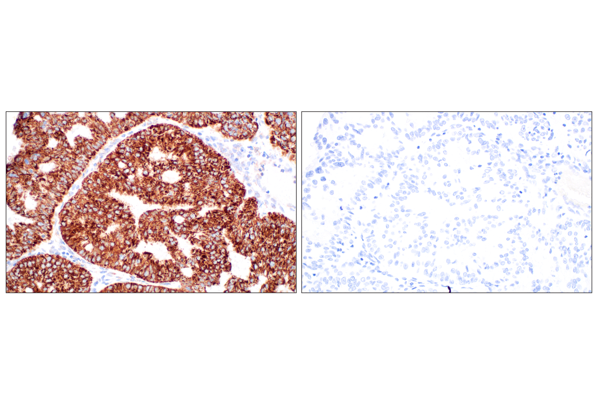 Immunohistochemistry Image 1: AIF (D39D2) XP® Rabbit mAb (BSA and Azide Free)