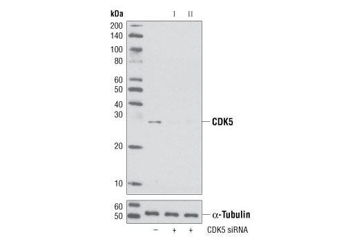  Image 1: SignalSilence® CDK5 siRNA II