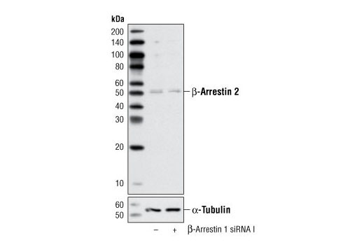  Image 1: SignalSilence® β-Arrestin 1 siRNA I