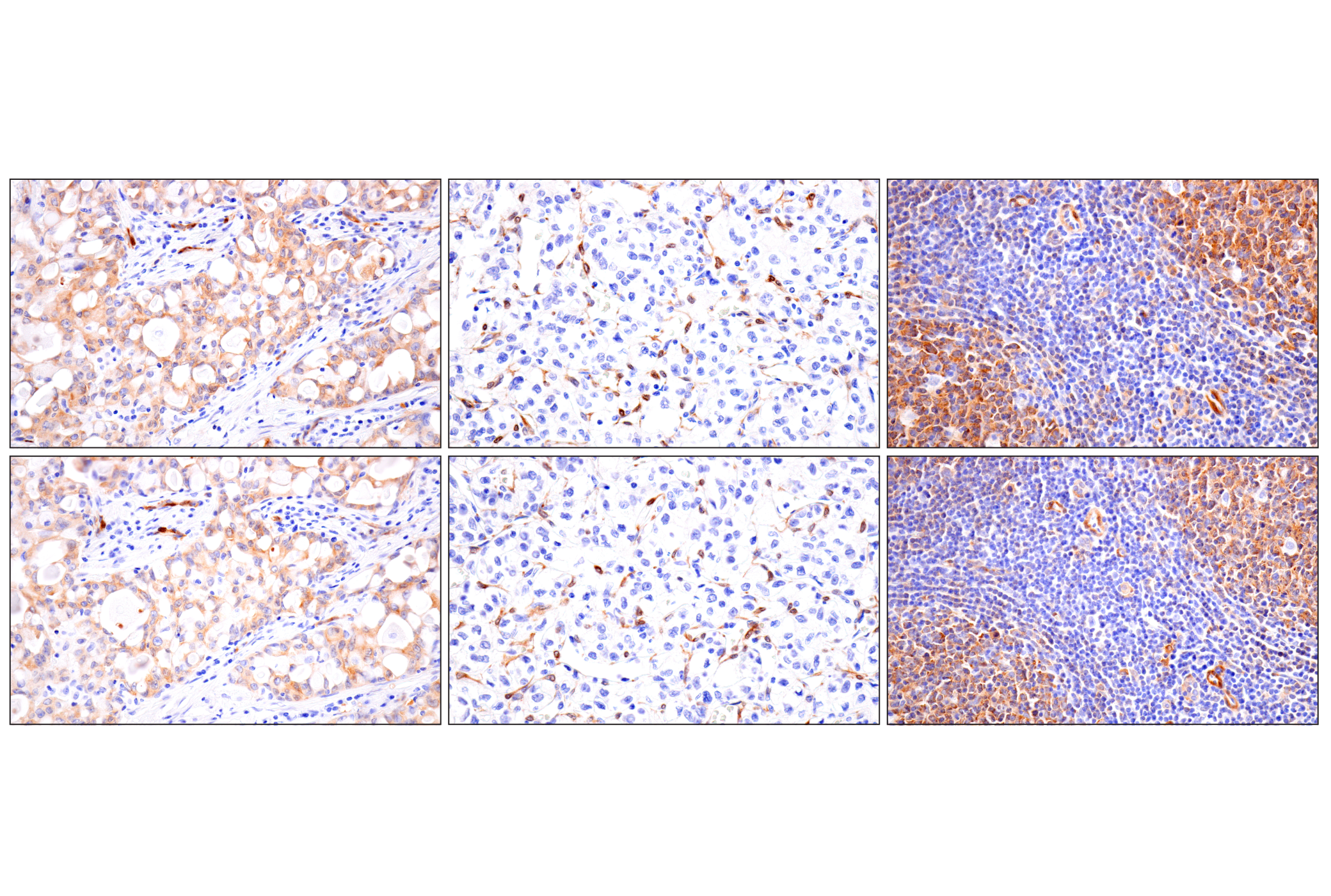 Immunohistochemistry Image 10: FAK (F7Z4C) Mouse mAb