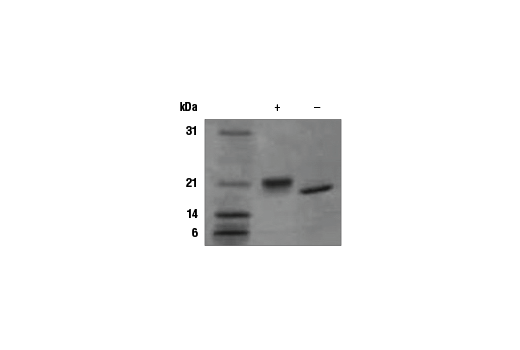  Image 1: Human LIF Recombinant Protein