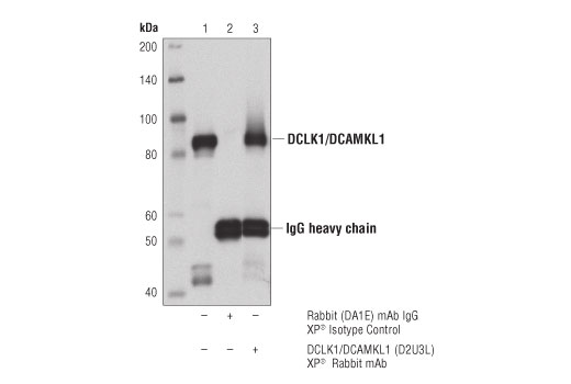 Immunoprecipitation Image 1: DCLK1/DCAMKL1 (D2U3L) XP® Rabbit mAb