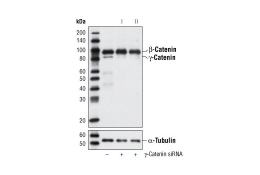  Image 1: SignalSilence® γ-Catenin siRNA I