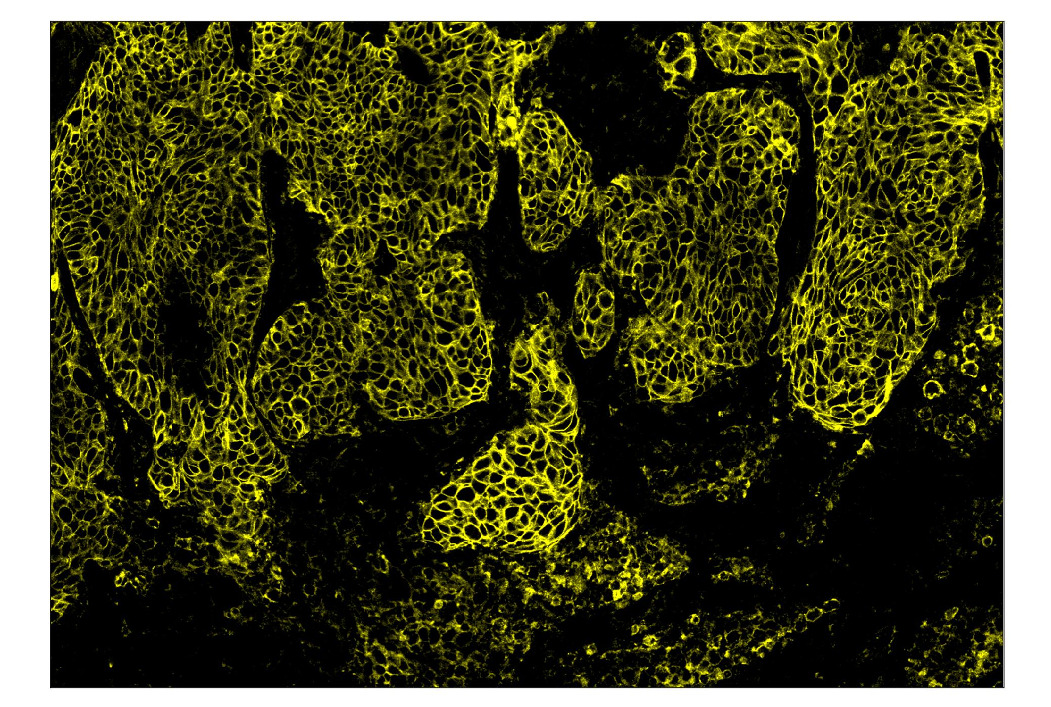 Immunohistochemistry Image 3: PD-L1 (E1L3N®) & CO-0005-647 SignalStar™ Oligo-Antibody Pair