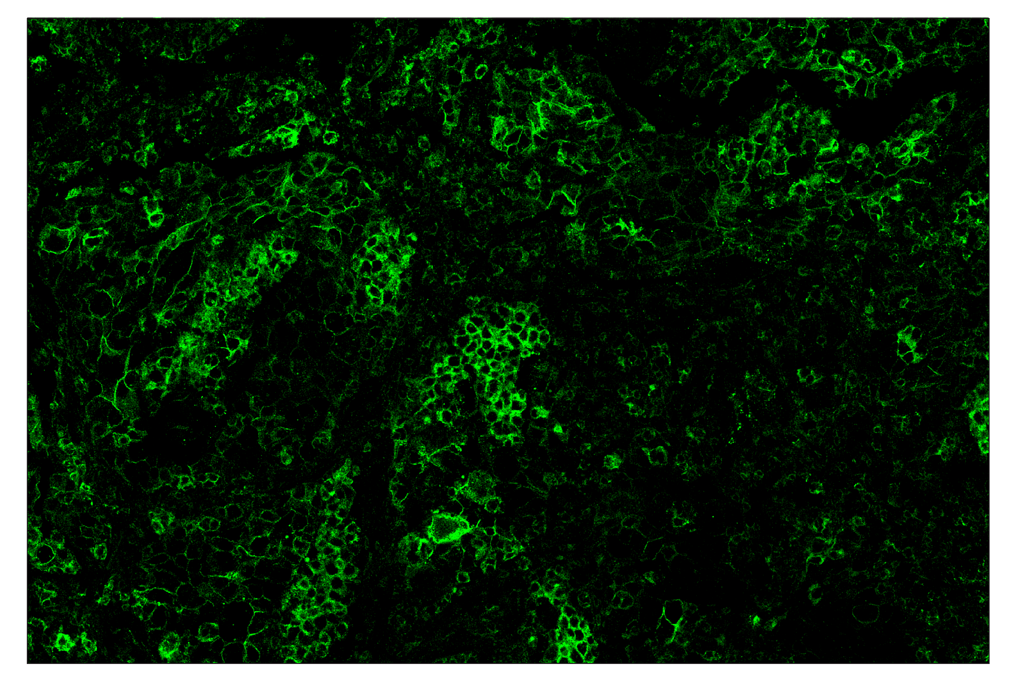 Immunohistochemistry Image 2: PD-L1 (E1L3N®) & CO-0005-488 SignalStar™ Oligo-Antibody Pair