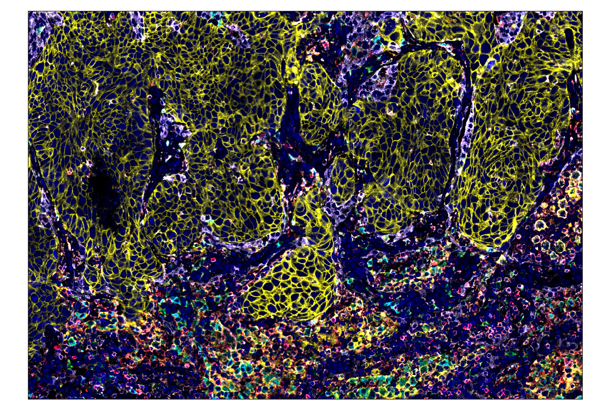 Immunohistochemistry Image 1: PD-L1 (E1L3N®) & CO-0005-594 SignalStar™ Oligo-Antibody Pair